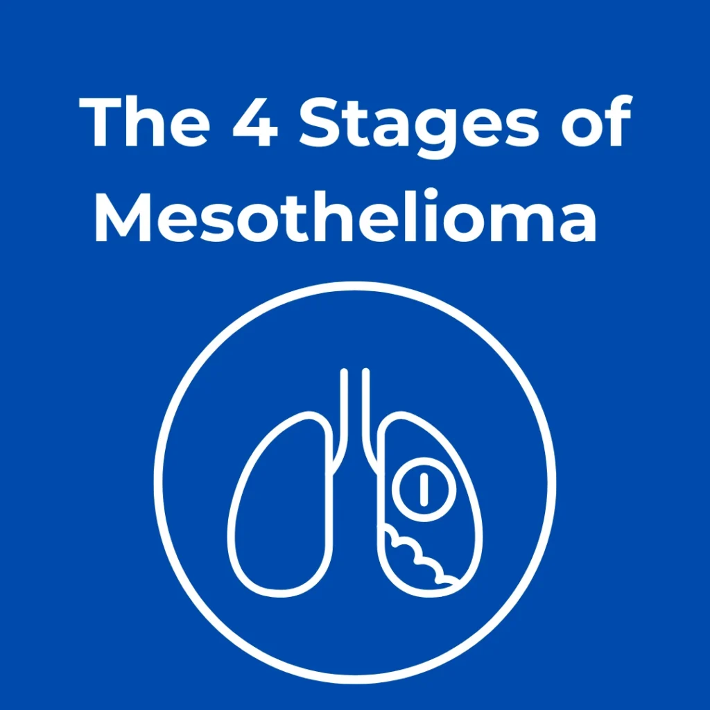 The 4 Stages of Mesothelioma