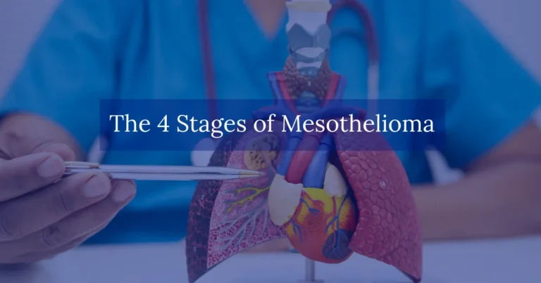 The 4 Stages of Mesothelioma
