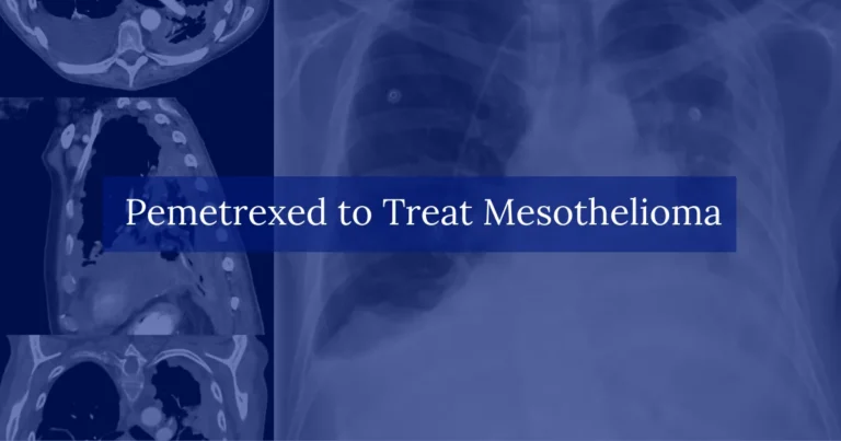 Pemetrexed to Treat Mesothelioma