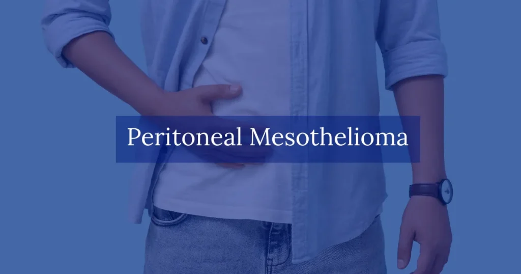 Peritoneal Mesothelioma