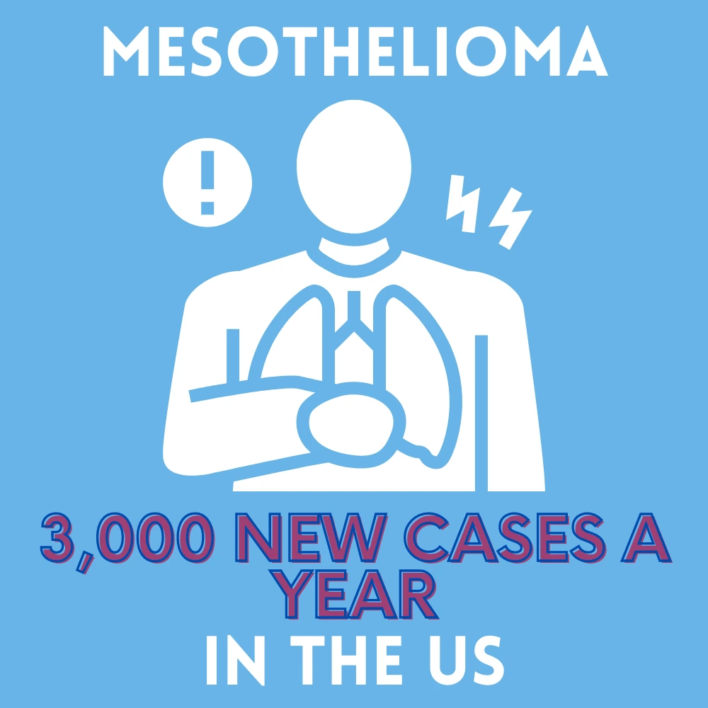 Mesothelioma: 3,000 new cases a year in the United States