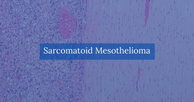 Sarcomatoid Mesothelioma