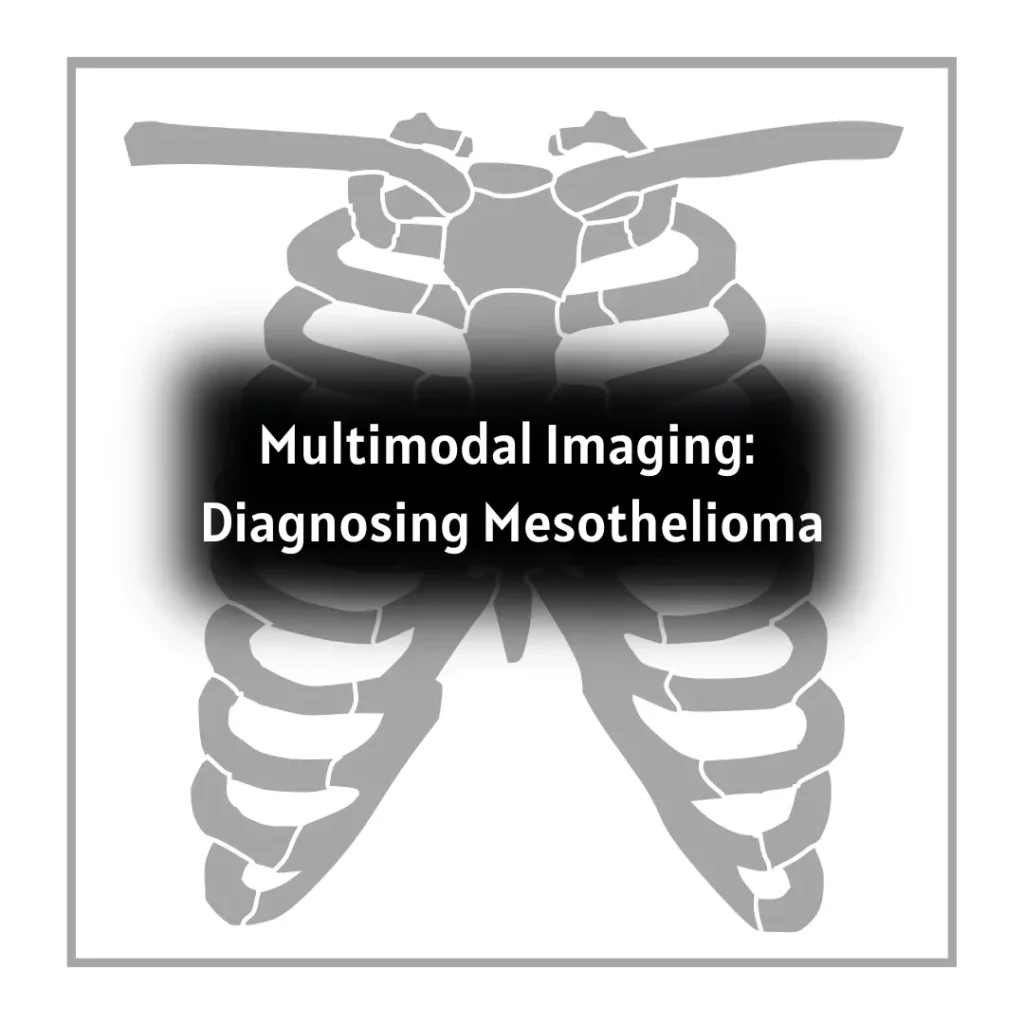 Multimodal Imaging: Diagnosing Mesothelioma