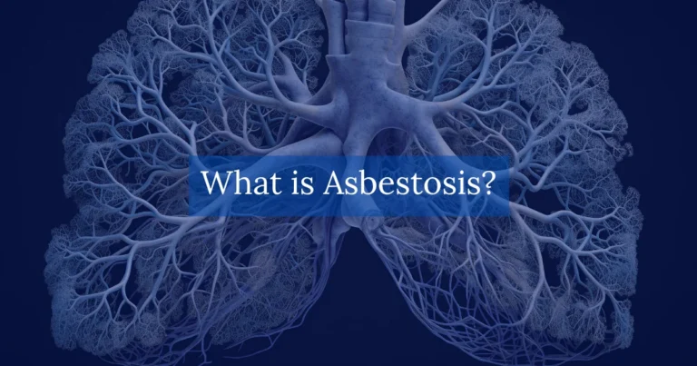 What is Asbestosis