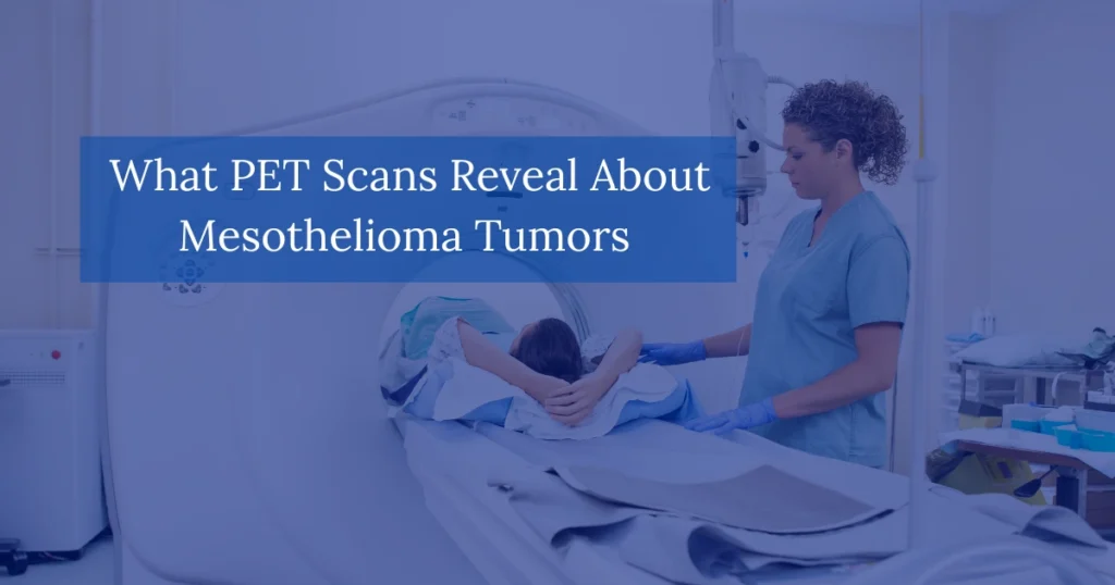 What PET Scans Reveal About Mesothelioma Tumors