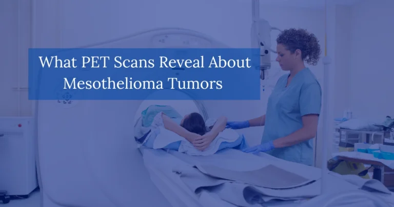 What PET Scans Reveal About Mesothelioma Tumors