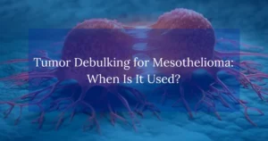 Tumor Debulking for Mesothelioma: When Is It Used?