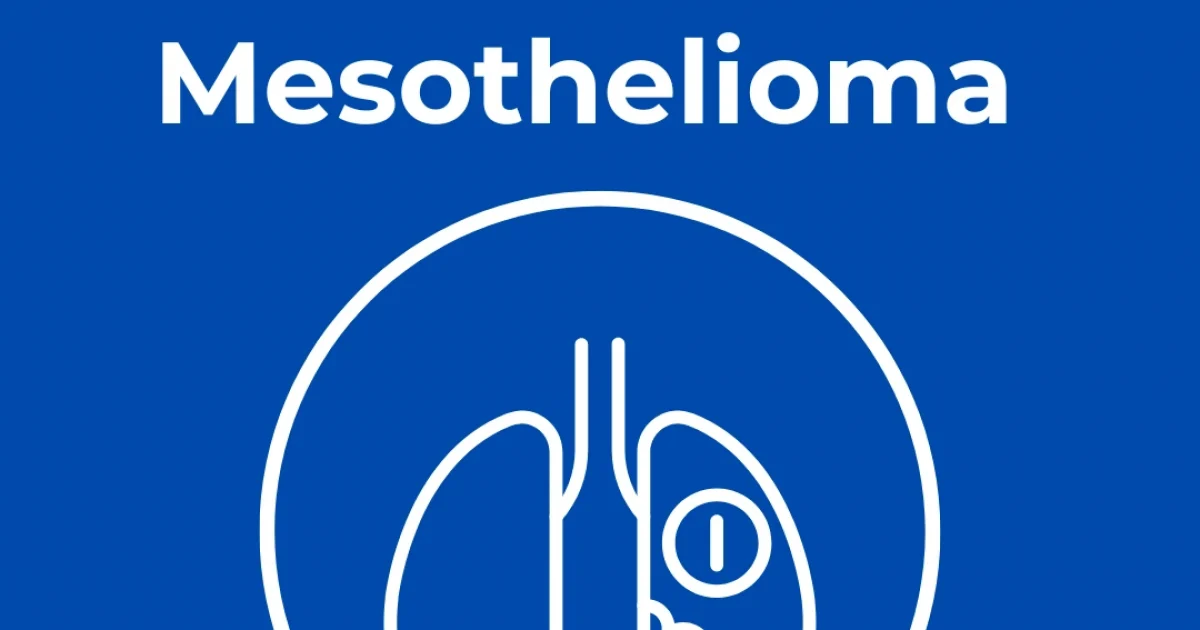 The 4 Stages of Mesothelioma