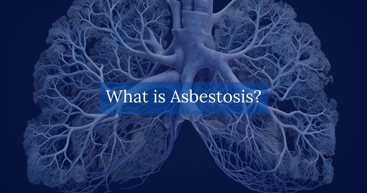 What is Asbestosis